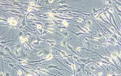 Glioma cell culture