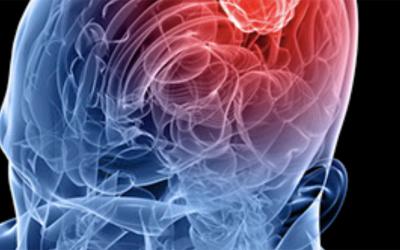Genomics and Epigenomics of Glioma Progression
